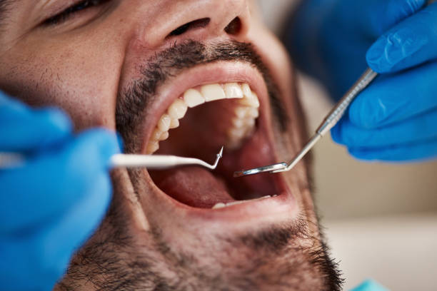 Best Broken Tooth Emergency  in Wilder, VT